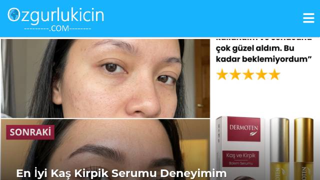 Thumbnail